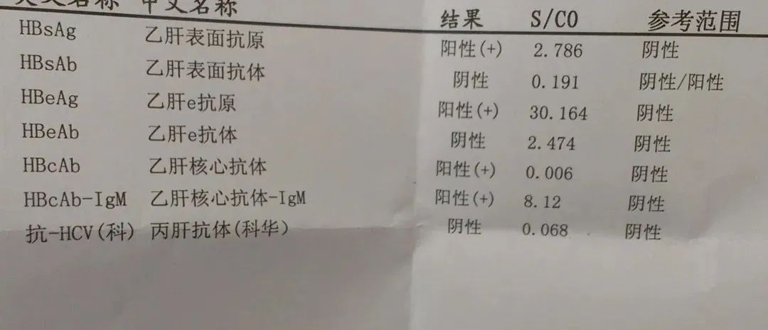乙肝大三阳孕期得肝掌,怀孕查出乙肝大三阳怎么办