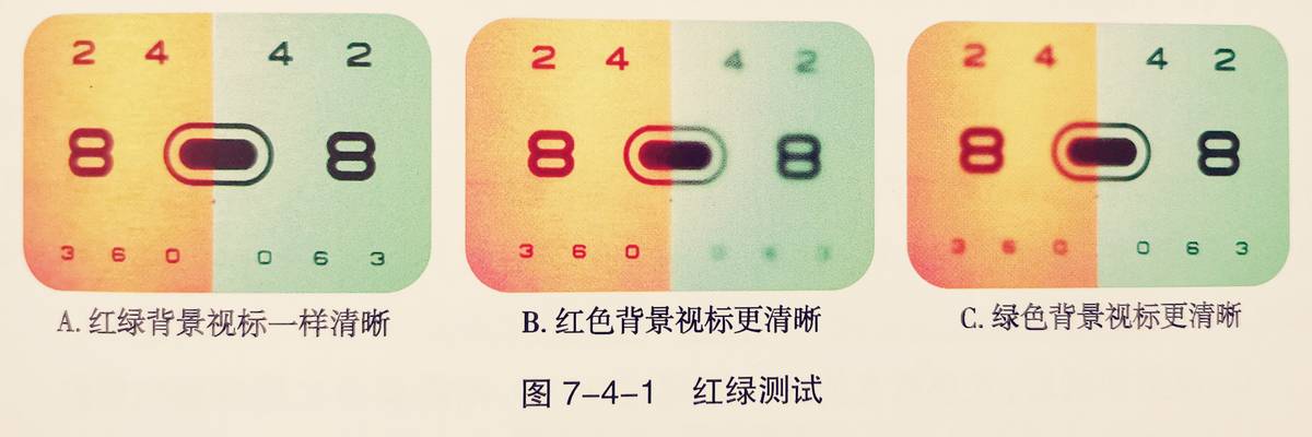 去医院做验光流程,眼镜配镜标准流程表