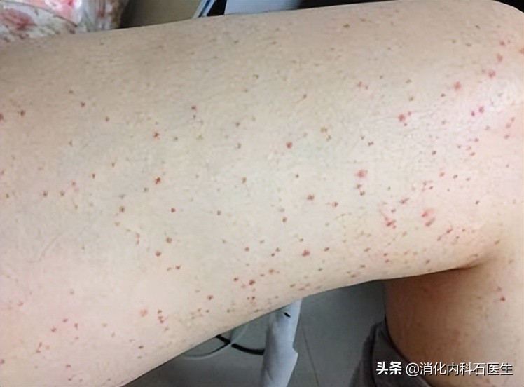 高中女孩子腹痛的原因,高中女生腹痛就医