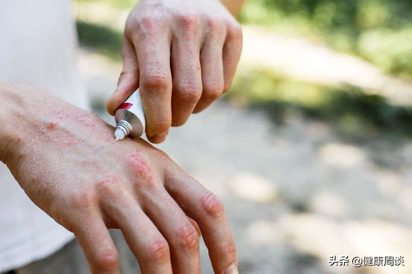 头部带状疱疹疼痛难忍怎么办,带状疱疹疼痛难忍如何处理