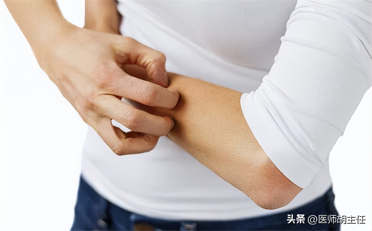 别把艾滋病当皮肤病治,不要错把艾滋病当皮肤病