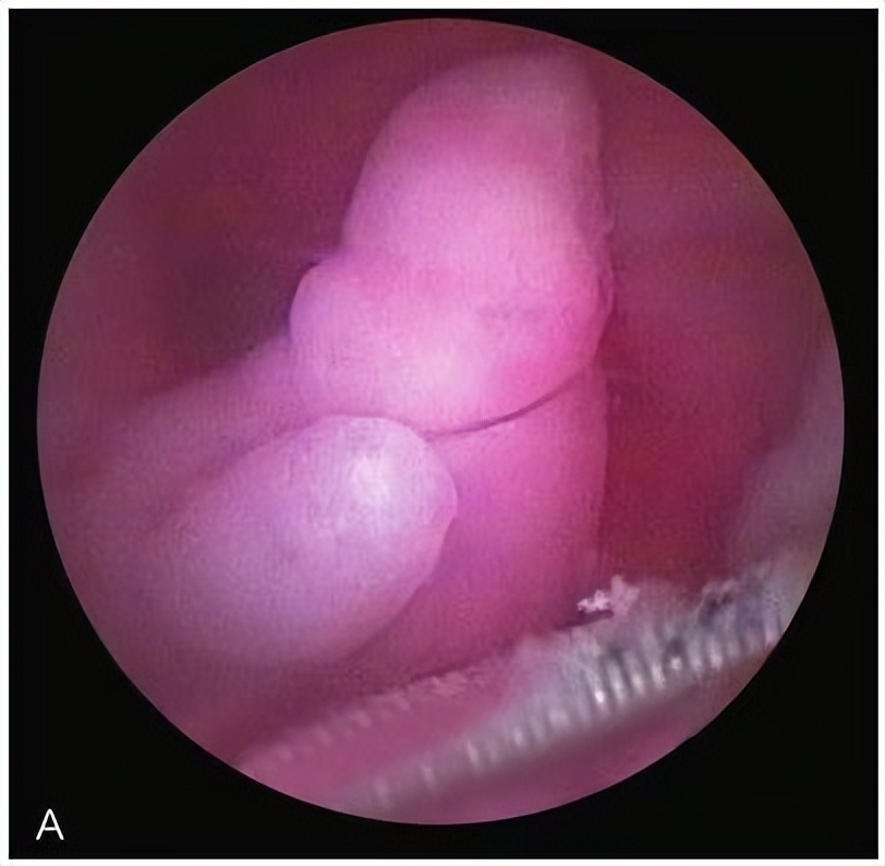 宫腔镜最好的医生,妇科医生科普的14个妇科知识