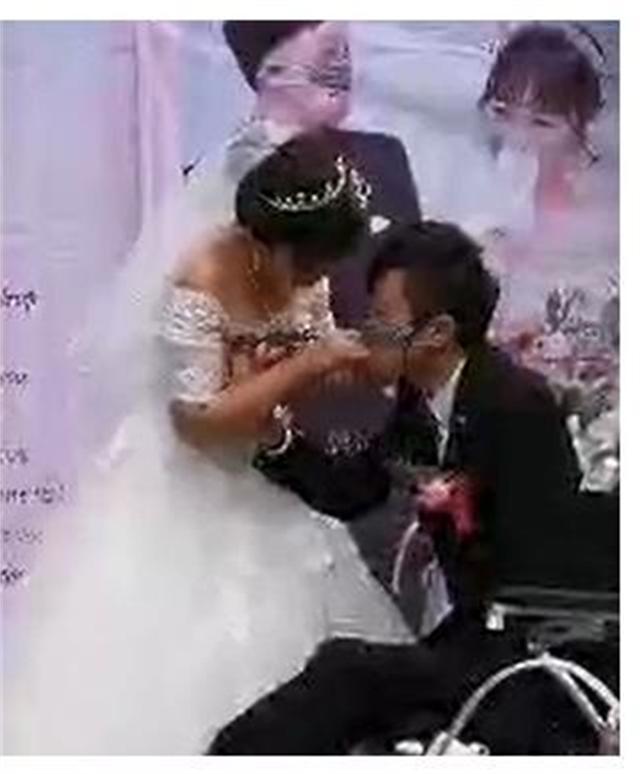 新郎救火时毁容新娘依然嫁给了他,新郎被烧伤新娘前往医院