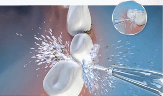 口腔健康冲牙器,牙线冲牙器十大排名