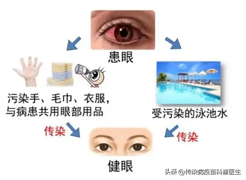 小孩眼睛红怎么办有时红的吓人,孩子眼睛红红的有血丝怎么办