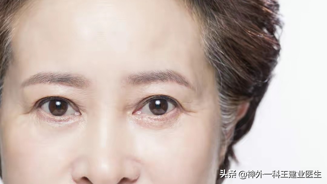 解决老年人视力下降的最好方法,老年视力下降应该补充什么维生素