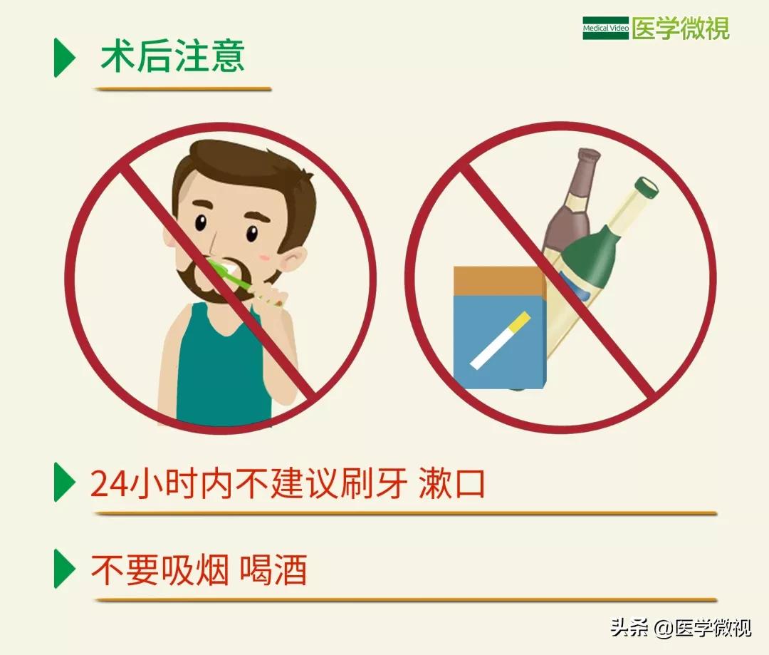 智齿摇晃厉害可以自己拔吗,拔智齿是硬把牙拽下来吗