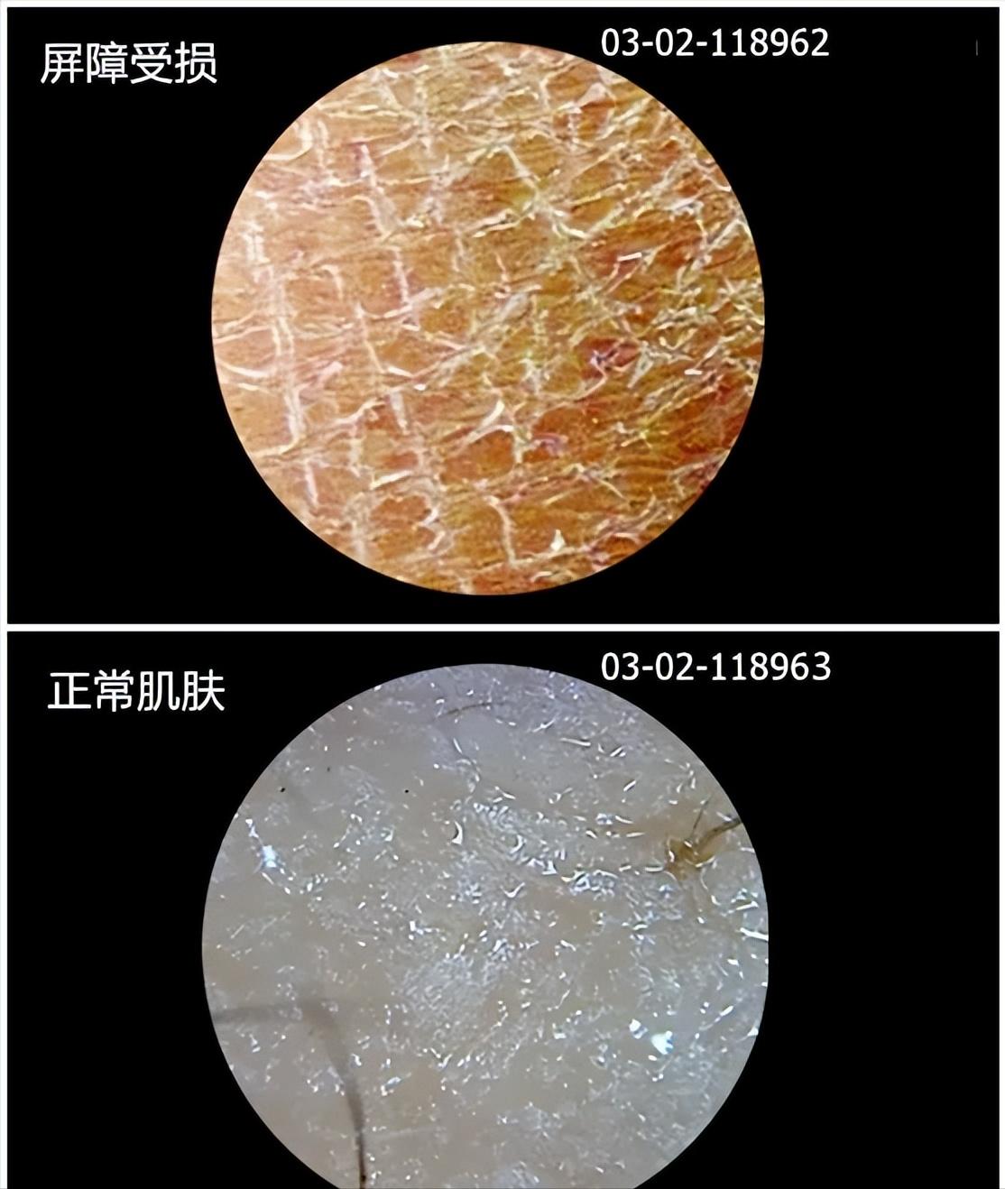 脸泛红是洗面奶的原因吗,为什么用完洗面奶脸会变白