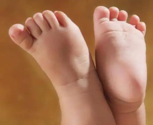 宝宝的脚丫该如何护理,宝宝光脚丫好吗