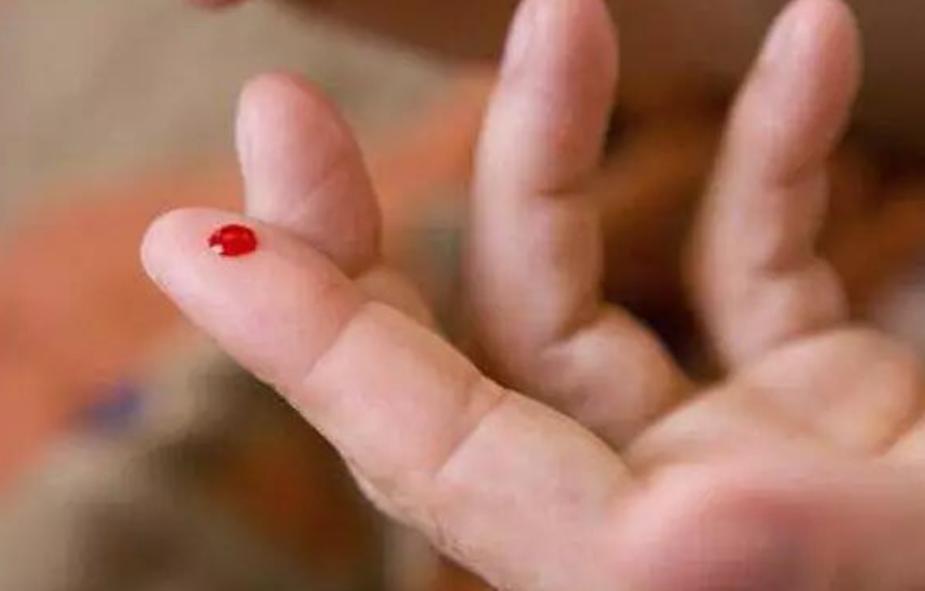 铁钉扎到脚要打破伤风吗,被铁钉扎了一下一定要打破伤风吗