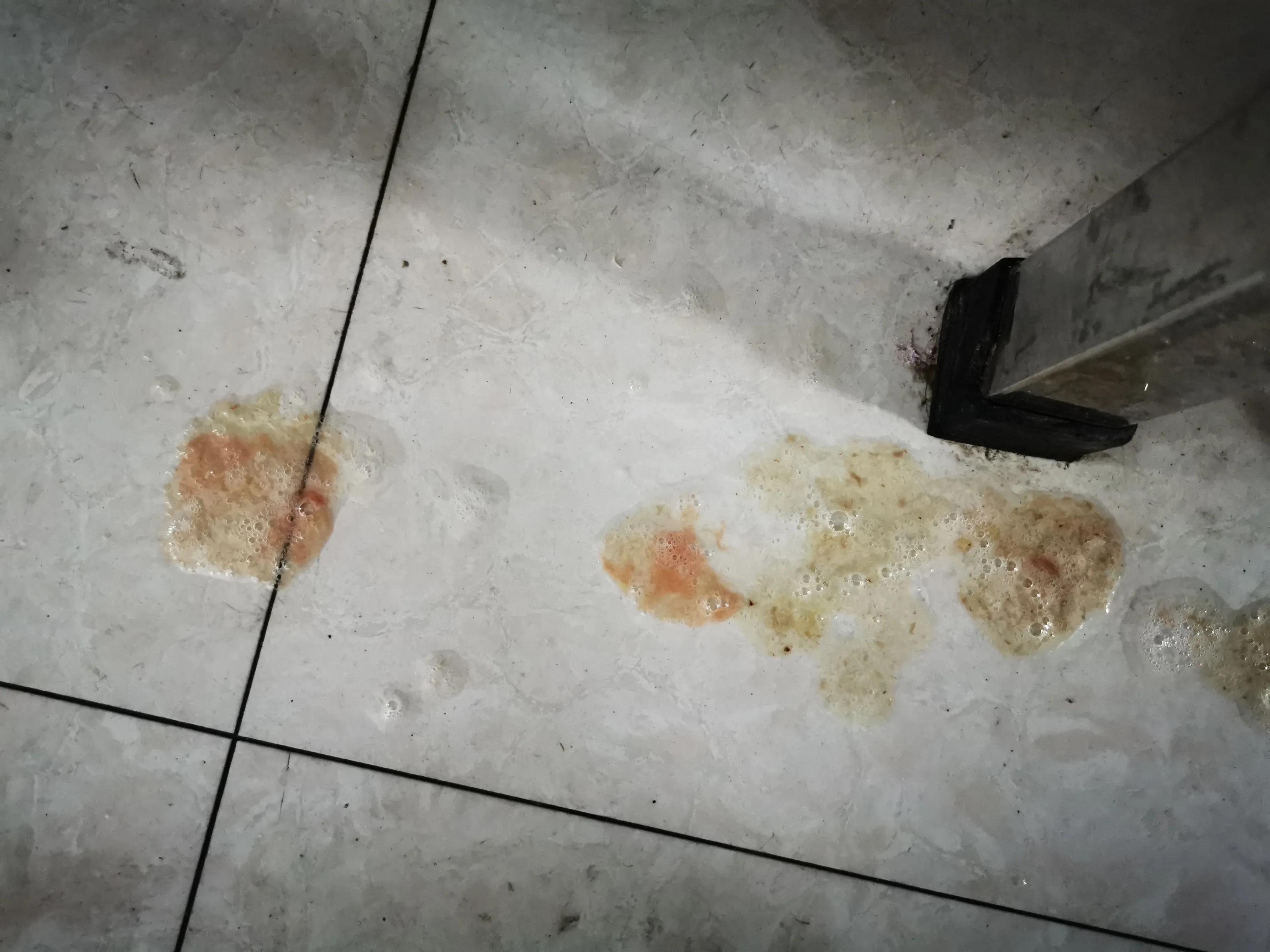 孩子发烧吃药注意事项,孩子发烧一定喂药防止并发症