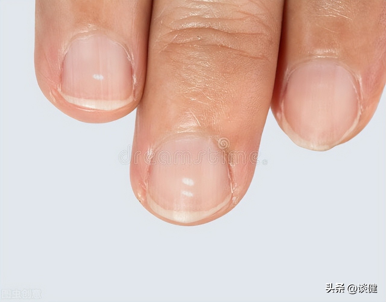 锌可以抗衰老吗,锌缺乏容易导致青少年应适当补锌