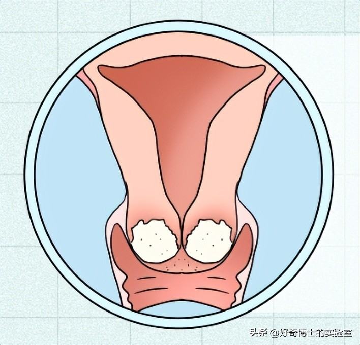*生活性**后，身体发生这5个变化正常吗？