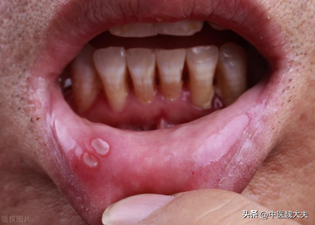 维生素b2身体警告,缺乏维生素b2身体会发出预警