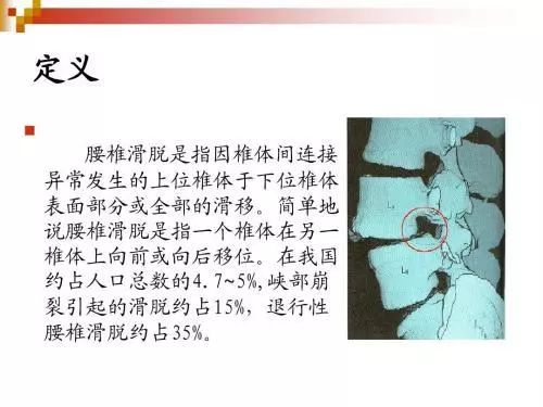 腰椎间盘突出吃了草药反而更疼,腰椎间盘突出煎熬