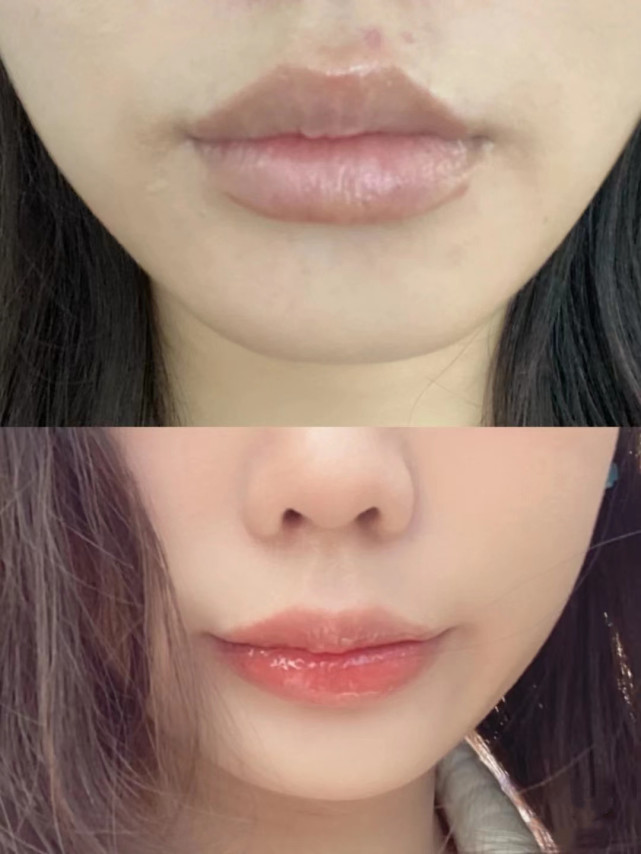 纹唇全过程教程自己操作,纹唇步骤全过程
