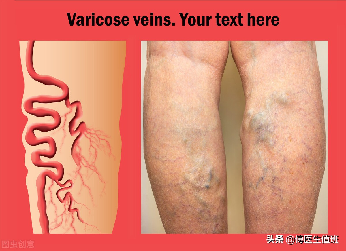 男子下肢瘙痒，长满溃疡就医，医生：错过最佳治疗时机，可能截肢