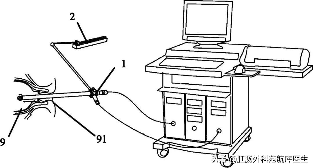 肛门镜和肠镜的区别