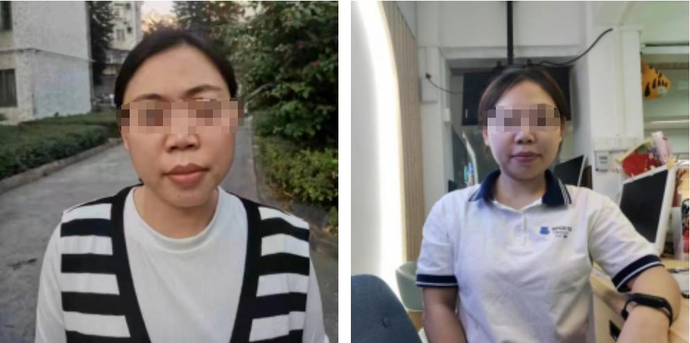 脖子歪睡觉能扶正吗,歪头多久可以矫正