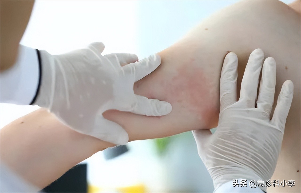 三种中药已经被禁用,六种已被叫停的家庭常用药