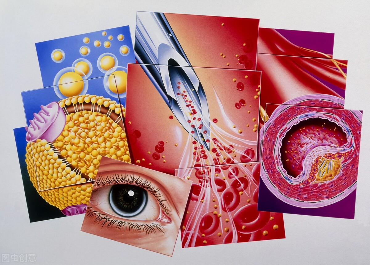 20岁高血脂饮食,25岁女生高血脂