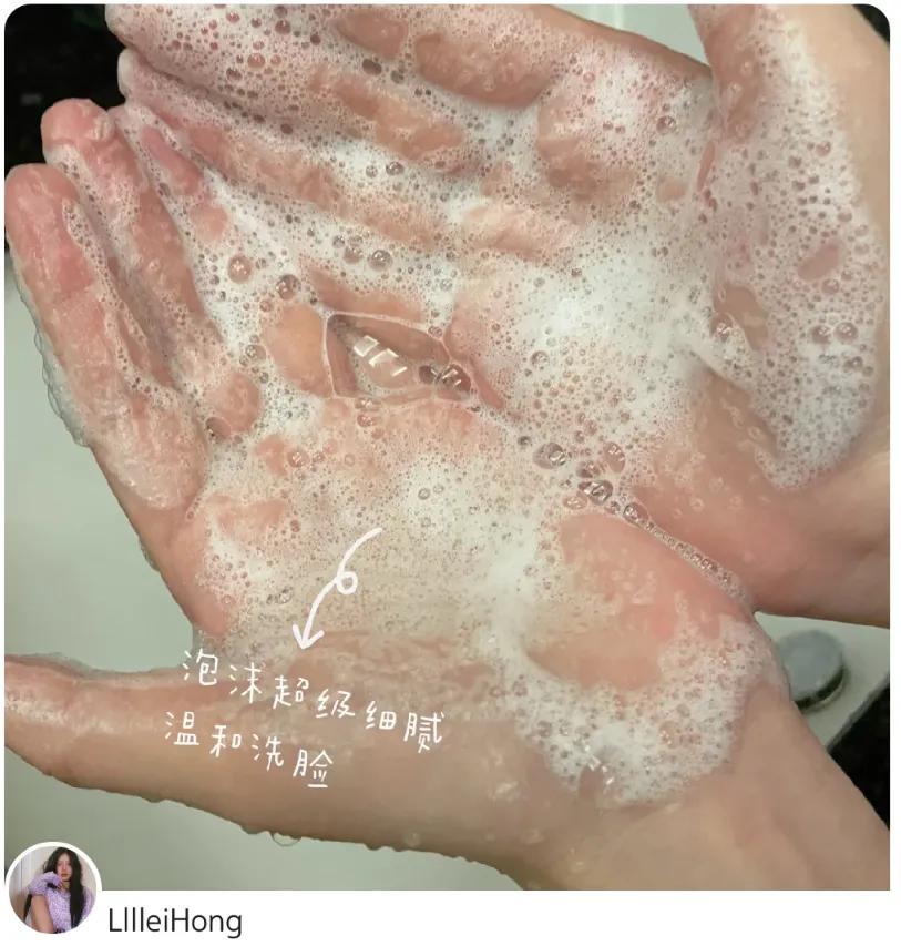 敏感肌比较适合的护肤品,有哪些适合敏感肌使用的护肤品