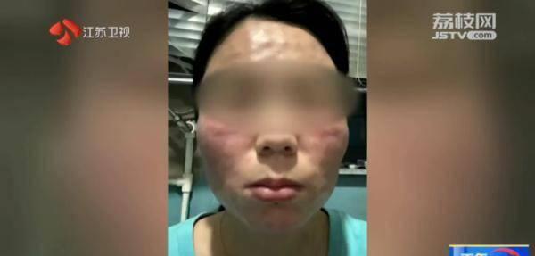 美容店顾客打水光后要求退款,美容院给顾客打水光针