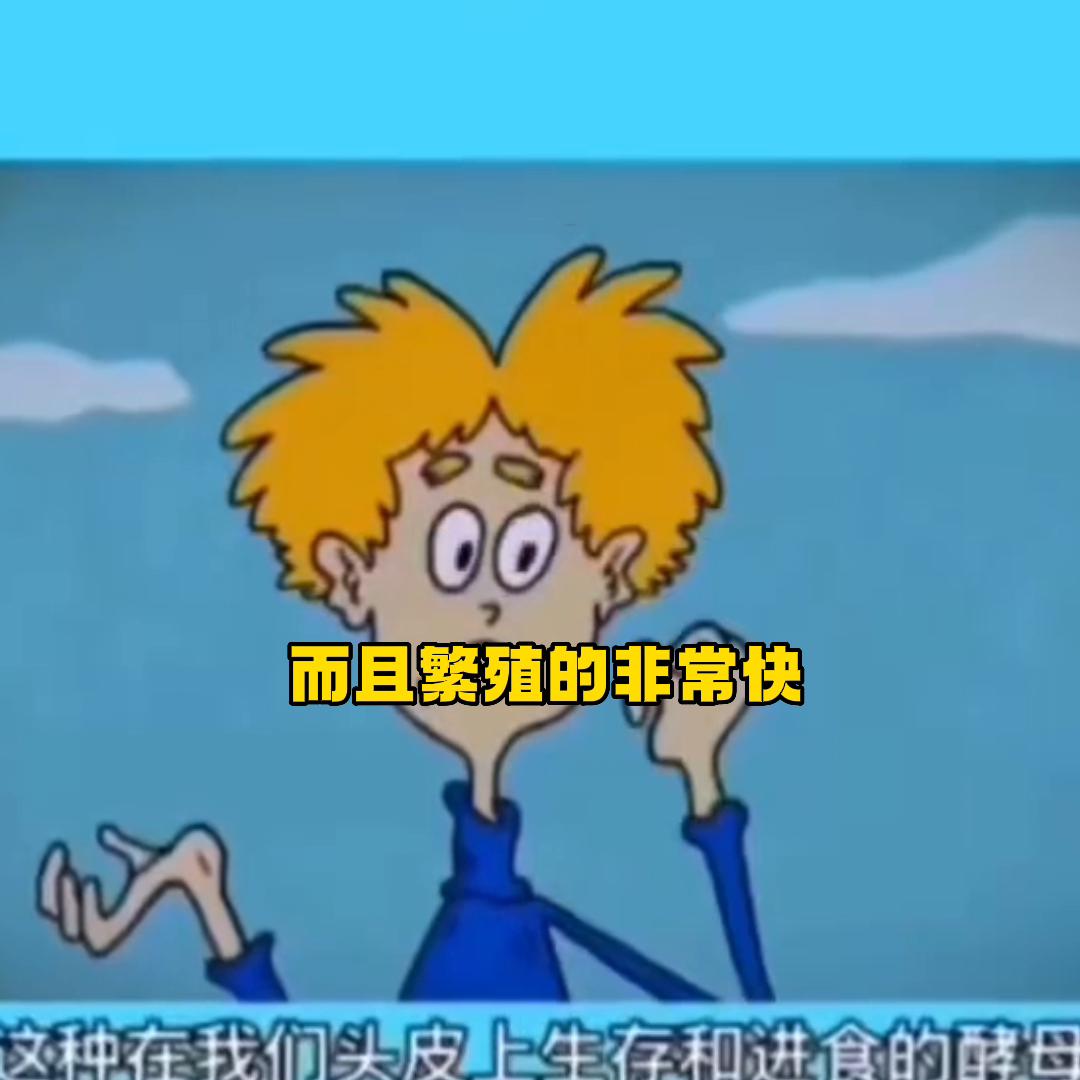 有头屑头皮痒的厉害怎么缓解,头痒头屑有什么小妙招彻底清除