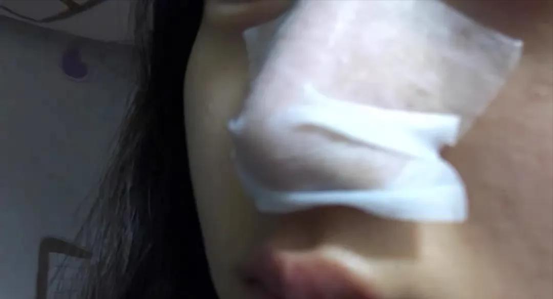 鼻子的黑头跟草莓一样,草莓黑头怎么去除最有效