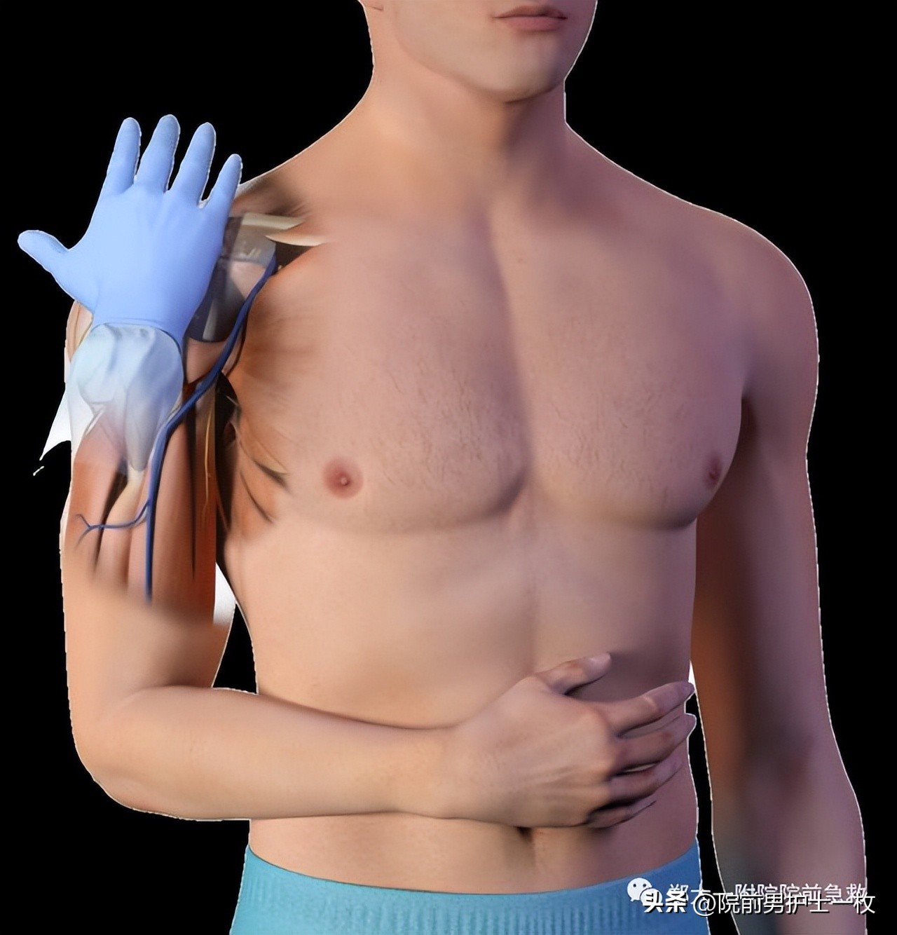 骨髓腔穿刺急救,骨髓腔穿刺适应症和禁忌症