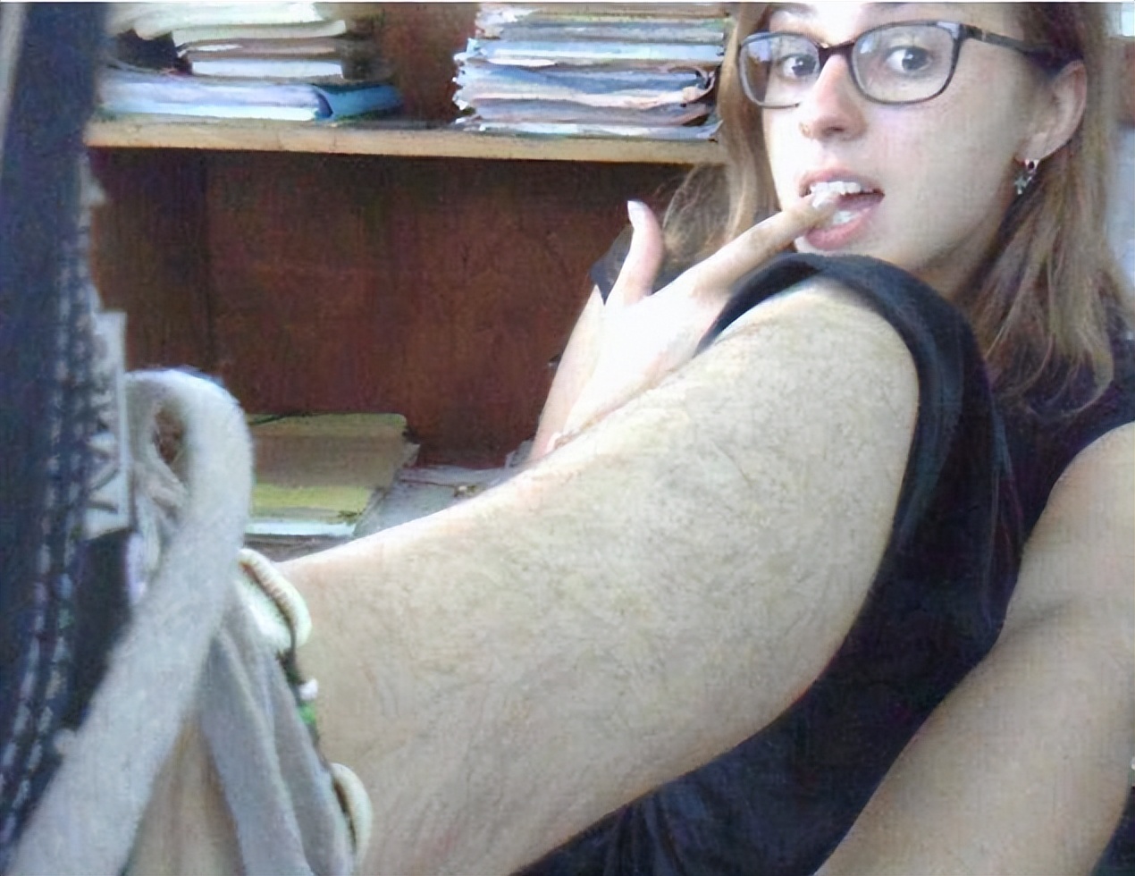 女性体毛重的症状都有什么,女性体毛茂盛的原因及治疗方法