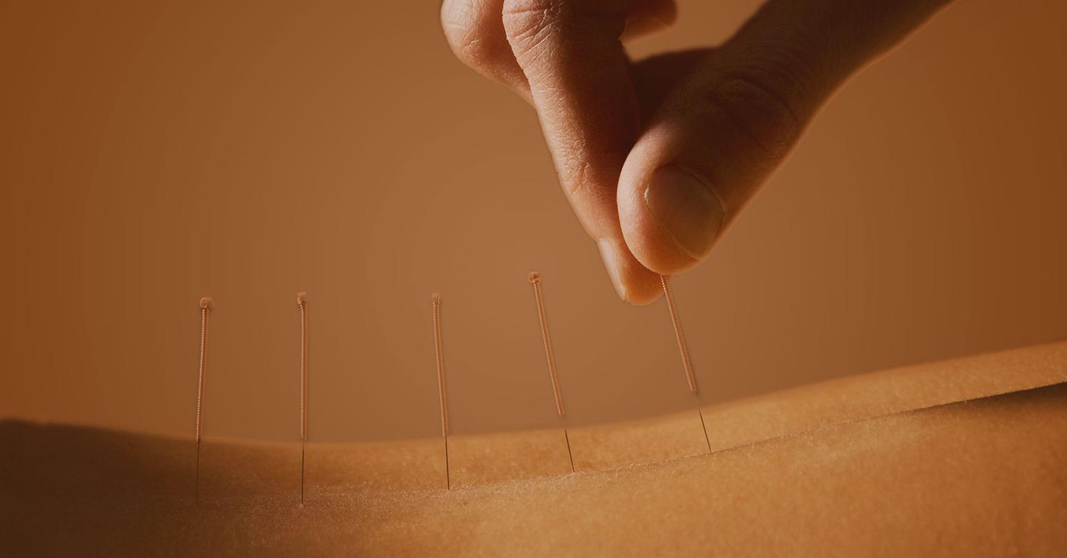 针灸临床经验选编精华,古法针灸临床治验