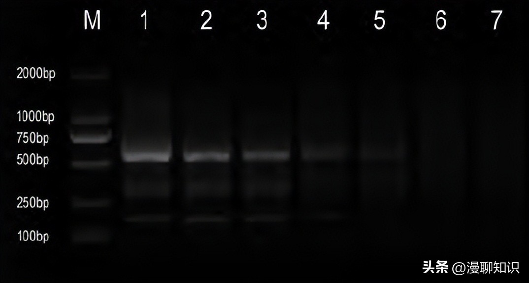 猫会感染人的疾病的图片,猫病毒检测cpr可以测出什么病毒