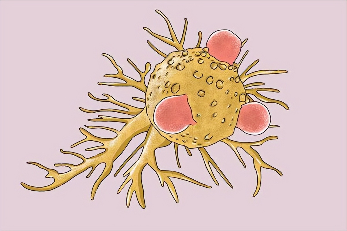 炎症到癌症一般多久,专家说长期炎症可能会拖成癌症