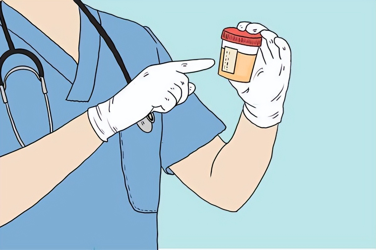 尿液发黄是不是身体有炎症,尿液发黄难闻什么原因