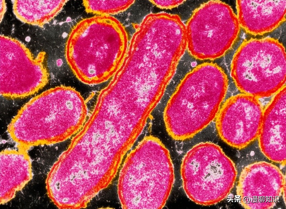 副猪嗜血杆菌是一种巴氏杆菌，其生长依赖于V因子，还有其他的吗