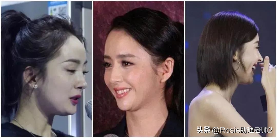 黎姿的下巴怎么改善的,黎姿面部变化