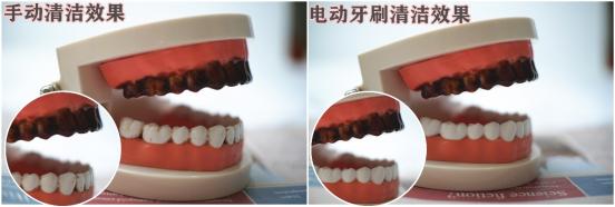 电动牙刷和普通牙刷对牙的好坏,飞利浦牙刷充电器如何判断好坏