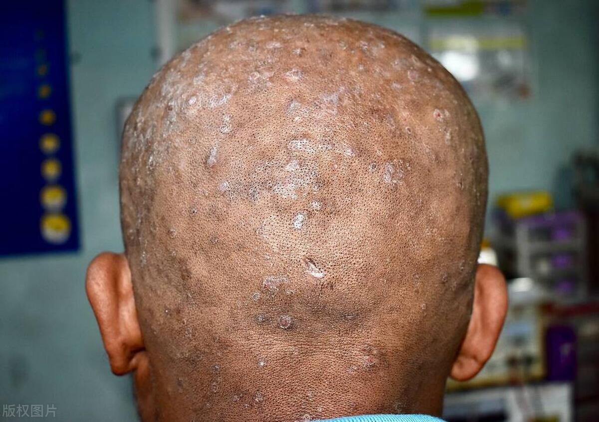 早上洗头跟晚上洗头哪个危害更大,早上洗头和晚上洗头哪个危害大