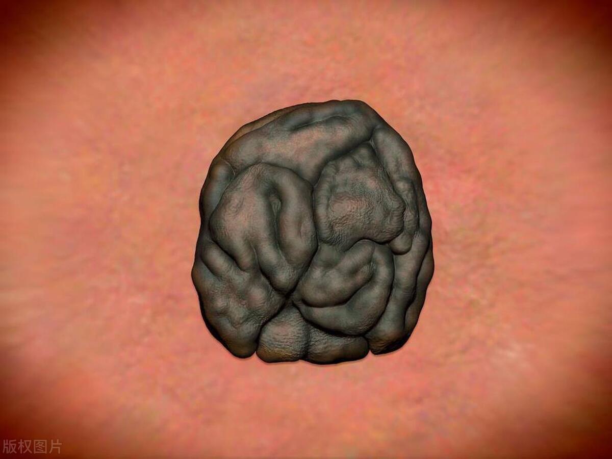 长在身体什么部位的痣容易癌变,脖子突然长痣是癌症的症状