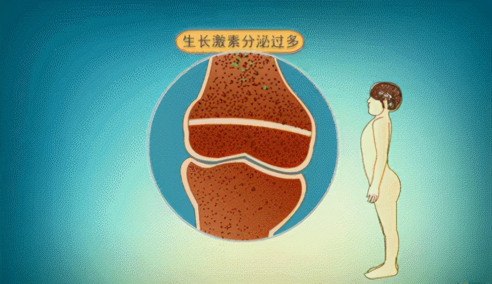 12岁男孩身高超过160的概率,12岁男孩升高2米