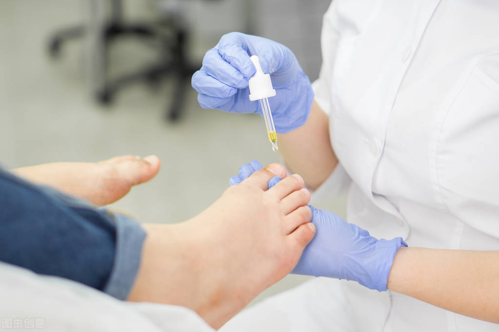 脚掌心水泡型足癣特别痒怎么办,脚趾发痒脱皮中医怎么诊断