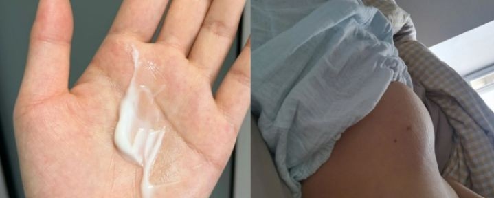 产后淡化妊娠纹品牌排行榜,产后妊娠纹霜全球排行榜