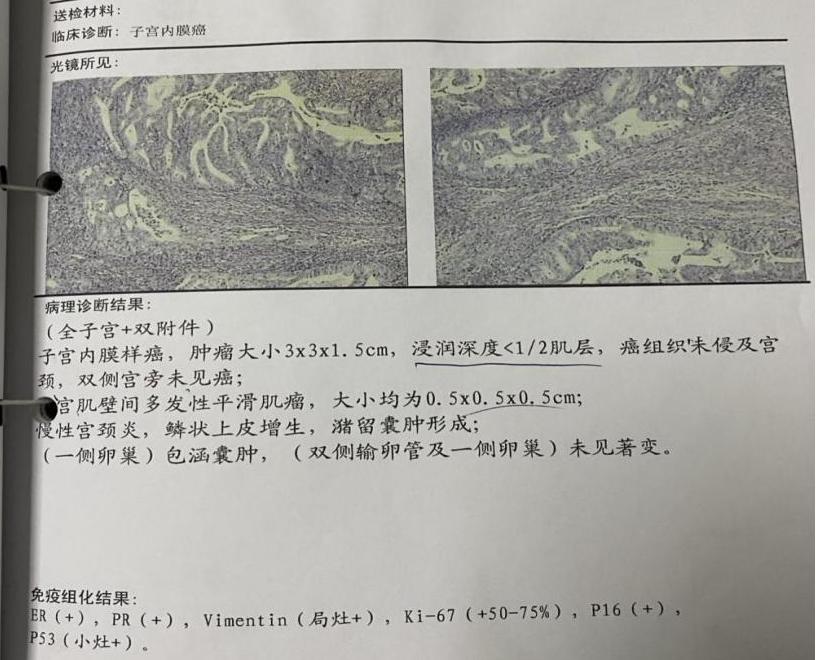 子宫多发肌瘤、宫腔积液、宫颈那囊、盆腔积液，这是什么病？