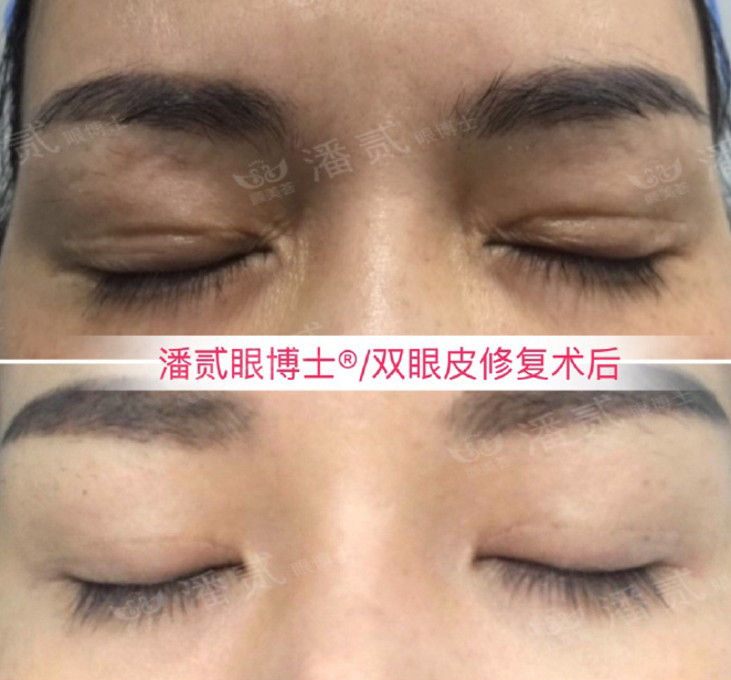 美容手术不想做了会退钱吗,美容整形不花钱