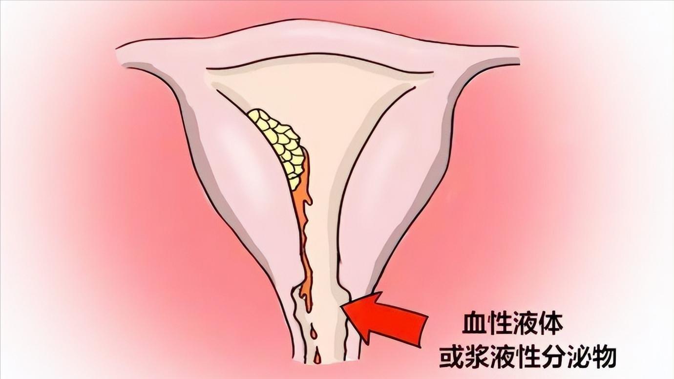 女性总是有异味怎么办,一般情况下女士有异味是怎么回事