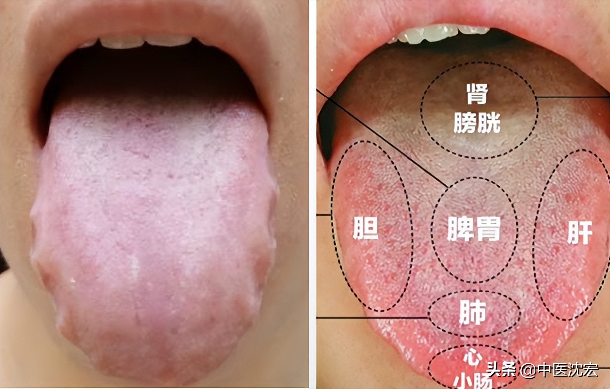 喉咙老有痰健脾祛湿化痰的中成药,喉咙痰多中医怎么祛痰