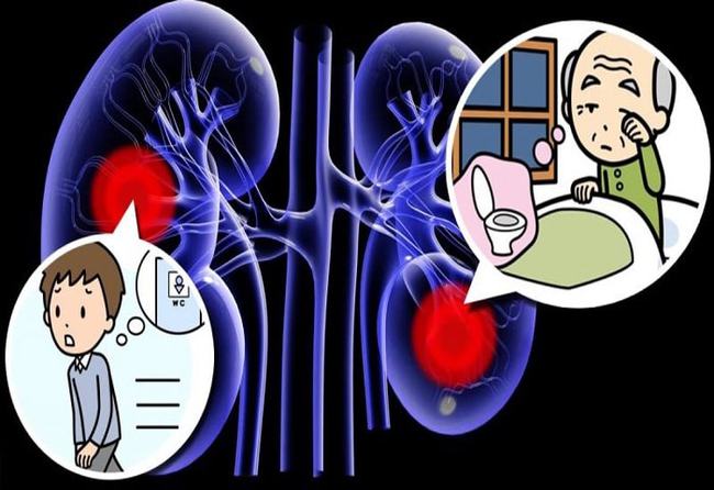 肌酸激酶高,肌酸酐偏高是什么病的前兆