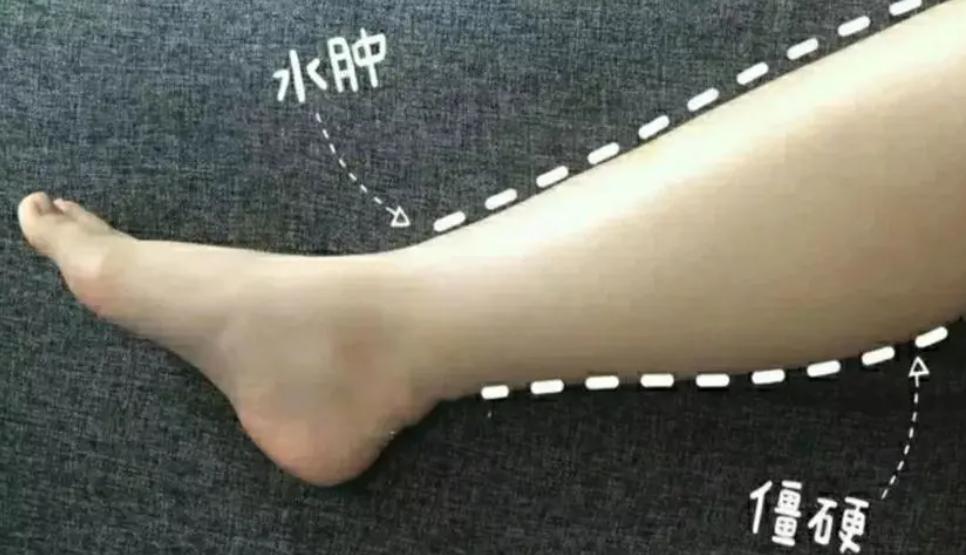 夜里起夜频繁是否肾有问题,经常起夜会不会肾衰竭