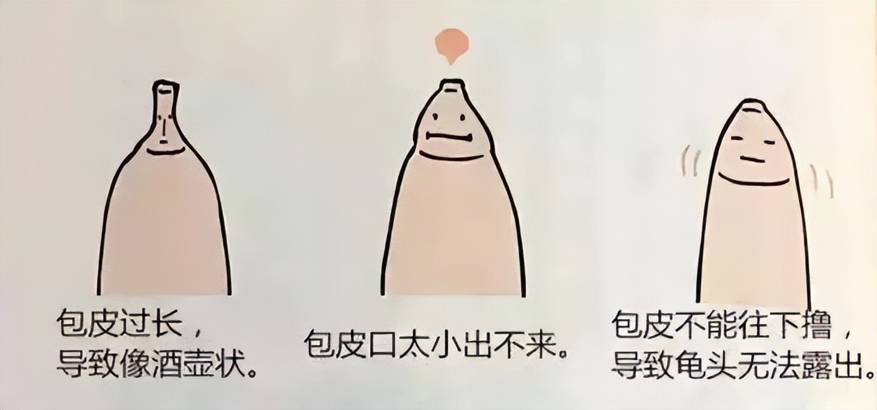 割吗?割啊!我在割包皮的医院走廊,唱完整首孤勇者